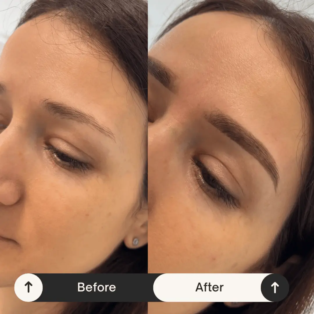 Before and after professional brow architecture and facial mapping in Chisinau